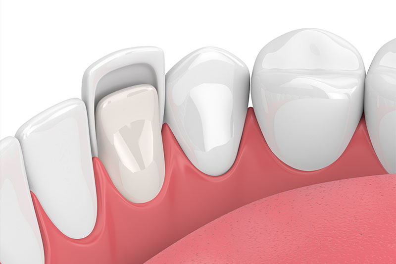 Cosmetic Dentistry in Slinger